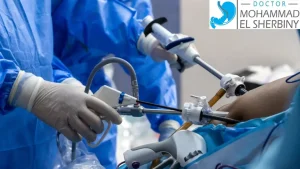 متى يجب إجراء منظار؟ دليلك لفهم الأسباب مع د. محمد الشربيني