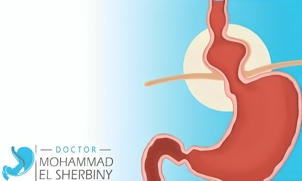 هل يلتئم فتق الحجاب الحاجز