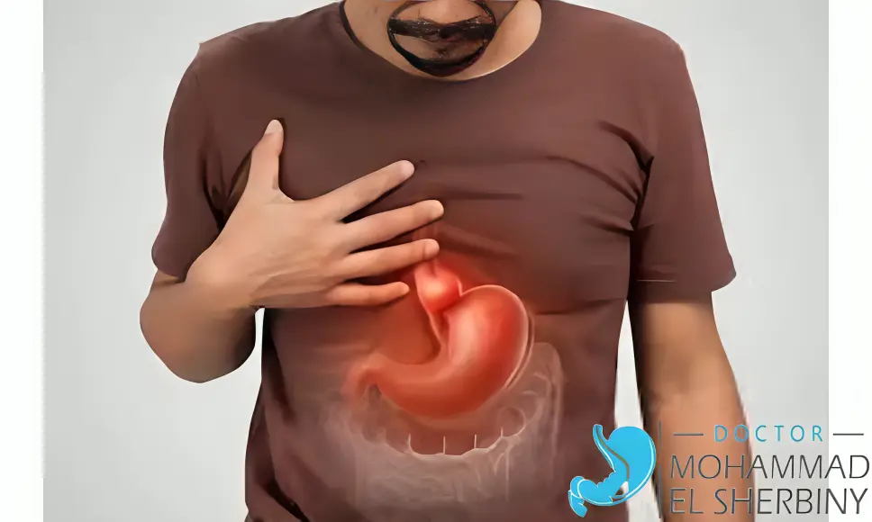 سعر عملية فتق الحجاب الحاجز بالمنظار