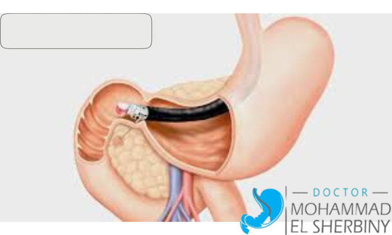 تكلفة منظار القنوات المرارية في مصر