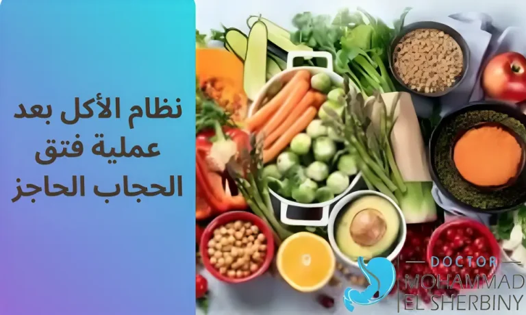 نظام الأكل بعد عملية فتق الحجاب الحاجز