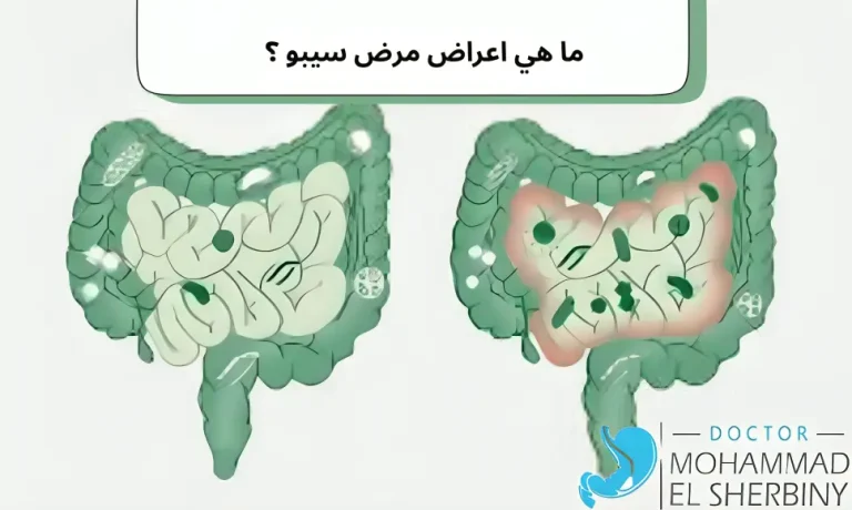 اعراض مرض سيبو sibo