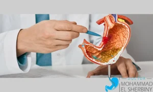 علاج كسل المعدة