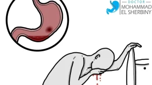 خطورة القيء الدموي​ ومتى تتوجه للطوارئ فوراً - د. محمد الشربيني