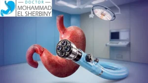 هل منظار المعدة مؤلم؟ د. محمد الشربيني يجيب كيف يُجرى بأمان