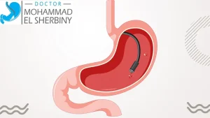هل منظار المعدة مؤلم؟ د. محمد الشربيني يجيب كيف يُجرى بأمان